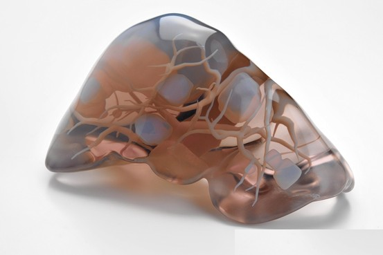 医生用3D打印机制造器官和骨骼（图文教程）,患者的肝副本,打印机,第2张